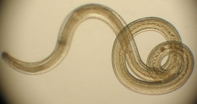 черви-паразиты человеческого организма